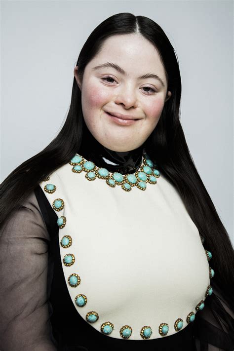 gucci down syndroom|down syndrome model gucci.